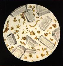 Аммонийные соли мочевой кислоты и кристаллы в форме крышки гроба