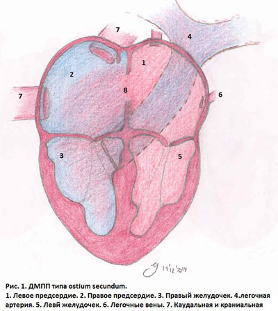 Дефект межпредсердной перегородки (ДМПП)– частый врожденный порок сердца у человека. В ветеринарной медицине ранее считался редко встречаемым. 